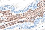 Collagen Type III Antibody in Immunohistochemistry (Paraffin) (IHC (P))