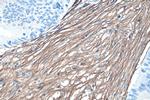 Collagen Type III Antibody in Immunohistochemistry (Paraffin) (IHC (P))