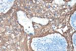 Collagen Type III Antibody in Immunohistochemistry (Paraffin) (IHC (P))