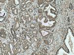 IkB Alpha Antibody in Immunohistochemistry (Paraffin) (IHC (P))