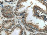 IkB Alpha Antibody in Immunohistochemistry (Paraffin) (IHC (P))