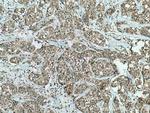 IkB Alpha Antibody in Immunohistochemistry (Paraffin) (IHC (P))