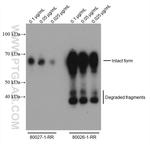 SARS-CoV-2 Nucleocapsid Phosphoprotein Antibody in Western Blot (WB)