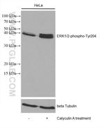 Phospho-ERK1/2 (Thr202, Tyr204) Antibody in Western Blot (WB)
