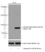 Phospho-Beta Catenin (Ser33) Antibody in Western Blot (WB)