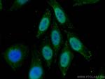 P53 Antibody in Immunocytochemistry (ICC/IF)