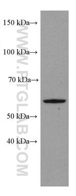 P53 Antibody in Western Blot (WB)