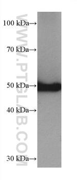 P53 Antibody in Western Blot (WB)