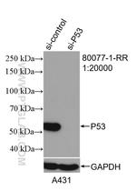 P53 Antibody in Western Blot (WB)