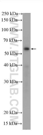P53 Antibody in Western Blot (WB)