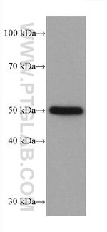 P53 Antibody in Western Blot (WB)