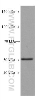 P53 Antibody in Western Blot (WB)
