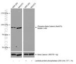 Phospho-Beta Catenin (Ser675) Antibody in Western Blot (WB)