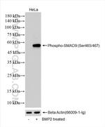 Phospho-SMAD9 (Ser465, Ser467) Antibody in Western Blot (WB)
