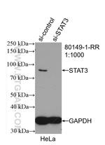 STAT3 Antibody in Western Blot (WB)