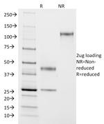 ASRGL1 (Asparaginase Like 1) Monoclonal Antibody (CRASH/1290)