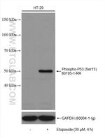Phospho-P53 (Ser15) Antibody in Western Blot (WB)