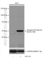 Phospho-P53 (Ser15) Antibody in Western Blot (WB)