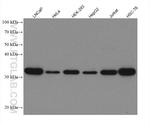 RPS6 Antibody in Western Blot (WB)