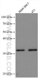 RPS6 Antibody in Western Blot (WB)