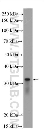 RPS6 Antibody in Western Blot (WB)