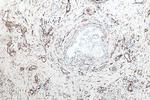 Vimentin Antibody in Immunohistochemistry (Paraffin) (IHC (P))