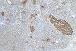 P62, SQSTM1 Antibody in Immunohistochemistry (Paraffin) (IHC (P))