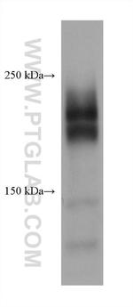 CD45 Antibody in Western Blot (WB)