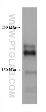 CD45 Antibody in Western Blot (WB)