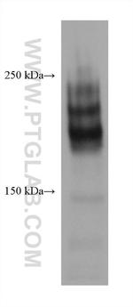CD45 Antibody in Western Blot (WB)