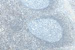 BCL2 Antibody in Immunohistochemistry (Paraffin) (IHC (P))
