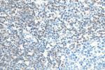 BCL2 Antibody in Immunohistochemistry (Paraffin) (IHC (P))