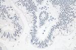 METTL3 Antibody in Immunohistochemistry (Paraffin) (IHC (P))