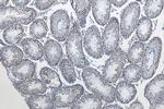 METTL3 Antibody in Immunohistochemistry (Paraffin) (IHC (P))