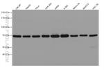 METTL3 Antibody in Western Blot (WB)