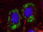 Perilipin-2 Antibody in Immunocytochemistry (ICC/IF)