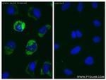 Perilipin-2 Antibody in Immunocytochemistry (ICC/IF)