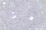 Perilipin-2 Antibody in Immunohistochemistry (Paraffin) (IHC (P))