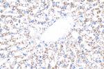 Perilipin-2 Antibody in Immunohistochemistry (Paraffin) (IHC (P))