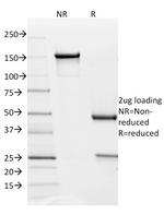 PD-L2/PDCD1LG2/CD273 Antibody in SDS-PAGE (SDS-PAGE)