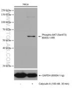 Phospho-AKT (Ser473) Antibody in Western Blot (WB)