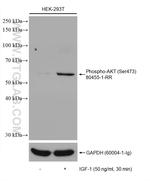 Phospho-AKT (Ser473) Antibody in Western Blot (WB)