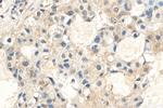 AKT1 Antibody in Immunohistochemistry (Paraffin) (IHC (P))