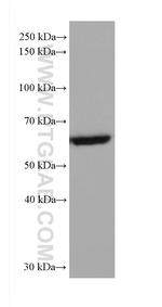 AKT1 Antibody in Western Blot (WB)