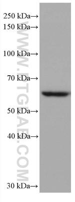 AKT1 Antibody in Western Blot (WB)