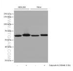 AKT1 Antibody in Western Blot (WB)