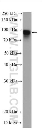 Beta Catenin Antibody in Western Blot (WB)