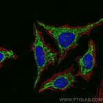 C1QBP Antibody in Immunocytochemistry (ICC/IF)