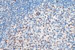 C1QBP Antibody in Immunohistochemistry (Paraffin) (IHC (P))