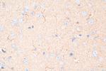 iNOS Antibody in Immunohistochemistry (Paraffin) (IHC (P))